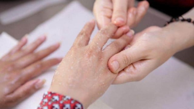 3 وصفات لتقشير وتنعيم اليدين بخطوات منزلية بسيطة