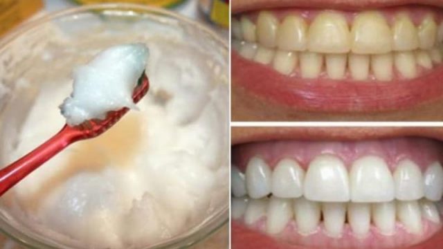 اصنعي بنفسك معجون أسنان زيت جوز الهند الطبيعي