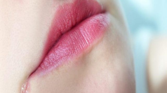 تعرفي على أفضل المكونات الطبيعية لعلاج التهاب زوايا الفم