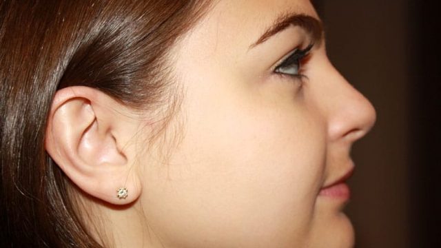 3 أقنعة منزلية لتنظيف البشرة الدهنية