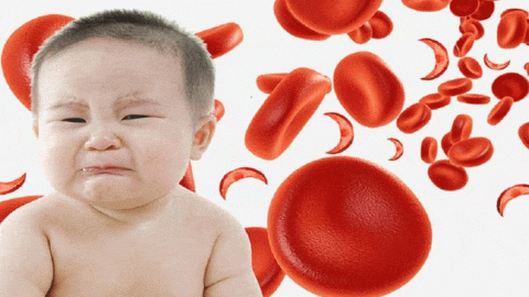 فقر الدم عند الأطفال.. الأسباب والأعراض وسبل العلاج