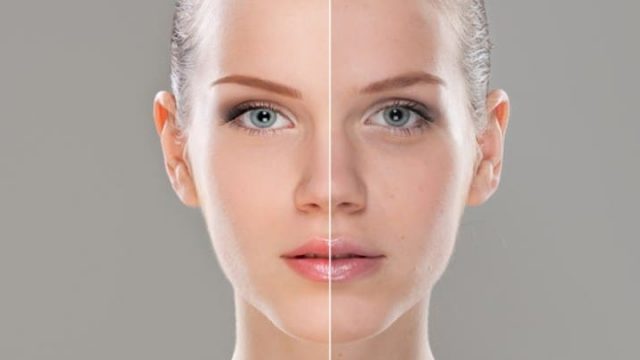 أقنعة طبيعية لعلاج البشرة الباهتة