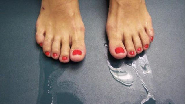علاجات منزلية للتخلص من فرط تعرق القدمين