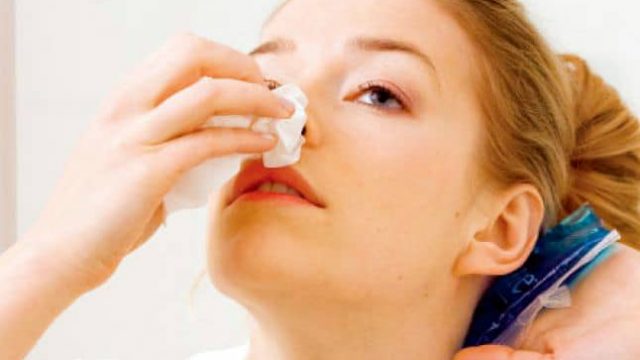 5 طرق طبيعية للحد من نزيف الأنف