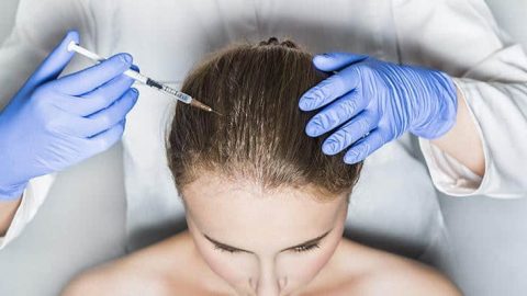 ماذا تعرفين عن فيلر الشعر؟