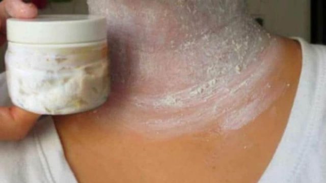 هل تعانين من اسوداد الرقبة؟ إليك هذه الحلول السريعة