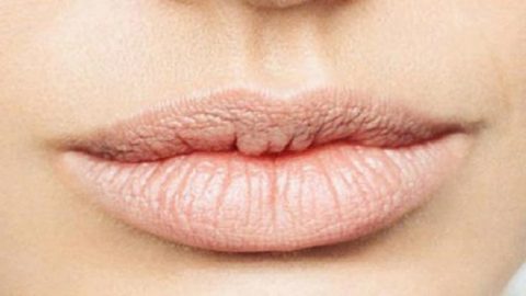 كيف أتعامل مع جفاف الشفاه؟