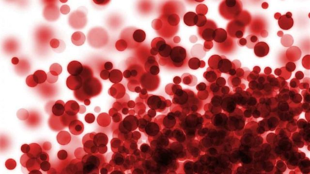 ماهي أعراض فقر الدم الحاد ؟