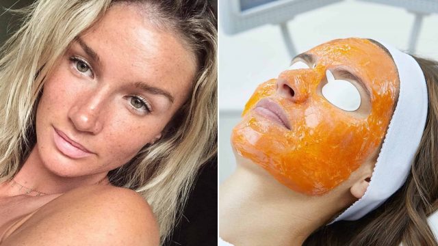 ماذا تعرفين عن تقنية Kleresca  لعلاج حبوب الشباب؟