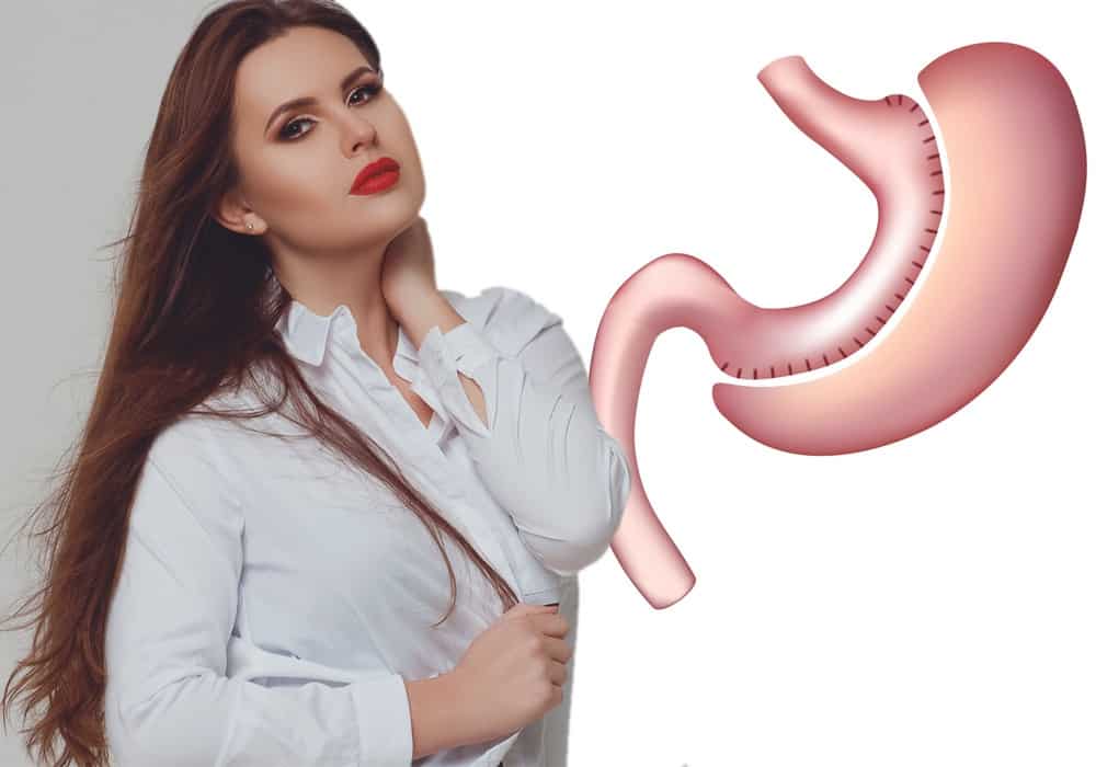 عملية تكميم المعدة 