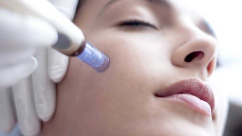 تعرفي أكثر على تقنية الميزوثيربي وخصائصها الجمالية