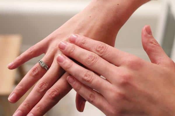 علاج للحروق طبيعي لا تستغني عنه