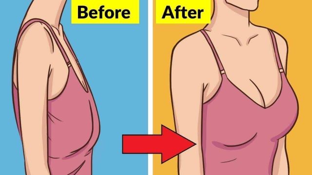 3 وصفات طبيعية لعلاج ترهل الثدي .. جربيها
