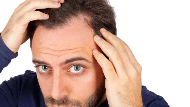 زراعة الشعر في دبي