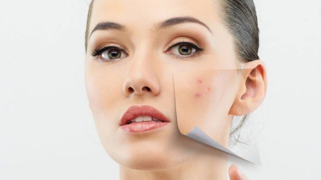 مكياج يومي في خطوات مع حيلة لتغطية البثور بشكل مثالي بالفيديو