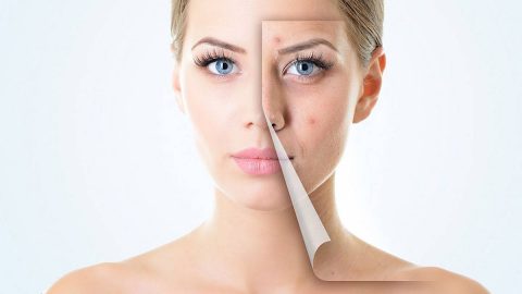 كيف تعتني ببشرتك إذا كان بها حبوب؟