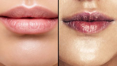 تغير لون الشفاه هل هو مشكلة جمالية أم صحية؟