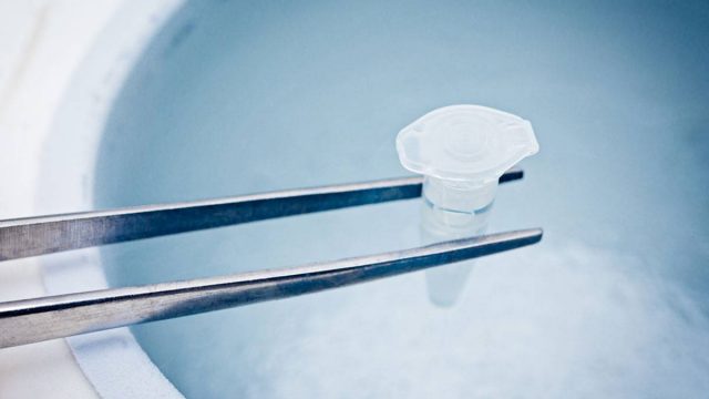 كل مايجب معرفته حول تجميد البويضات
