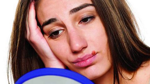 وصفات لعلاج القروح الباردة بمكونات تجدينها في مطبخك