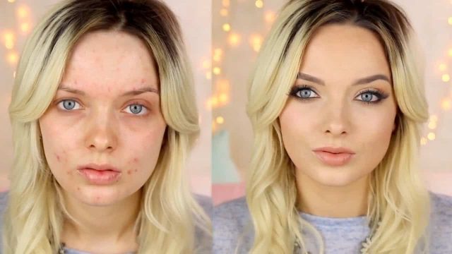 كيف تضعين المكياج لبشرة تعاني من حب الشباب ؟