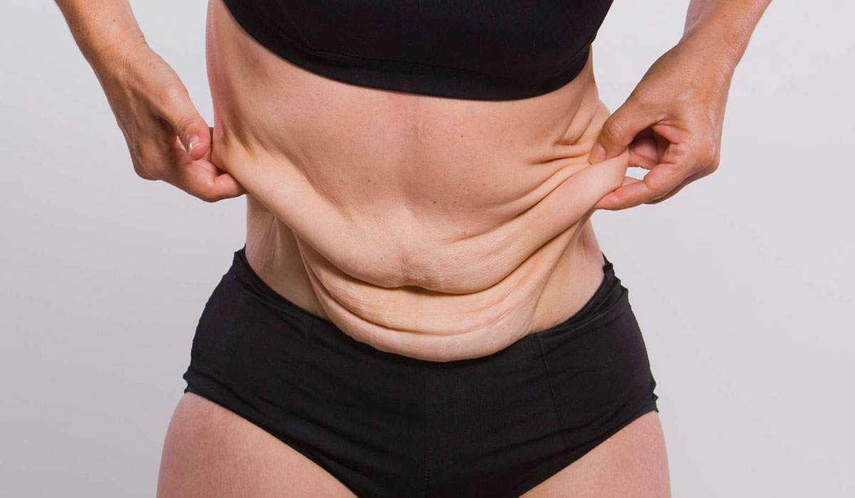  الشعر بعد عملية التكميم