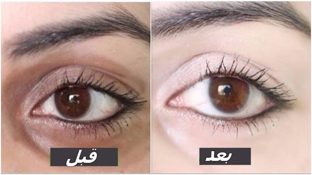 جربي أفضل الأقنعة الطبيعية لعلاج الهالات السوداء في محيط العيون