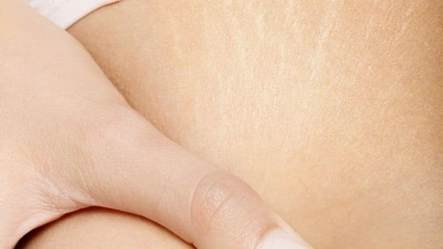 اكتشفي أجود 7 كريمات لشد الجسم بشكل آمن