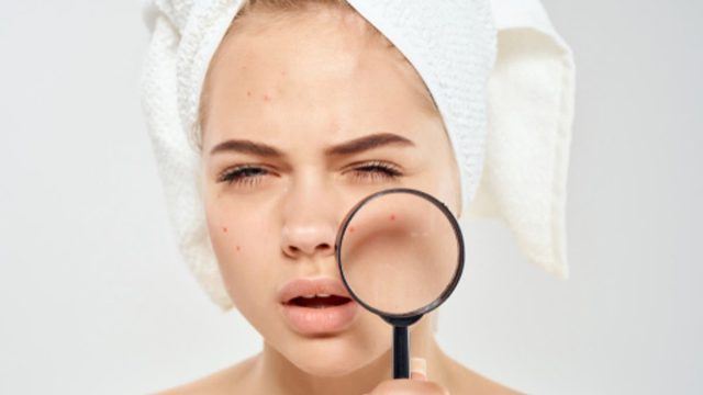 4 أسباب غير متوقعة تسبب البقع البنية!