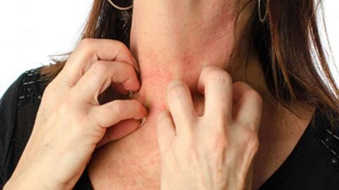 نصائح وإرشادات لعلاج تينيا الرقبة