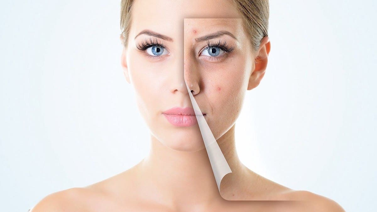  الحبوب على البشرة