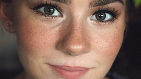 أخطاء مكياج للبشرة التي تعاني من النمش.. تعرفي عليها
