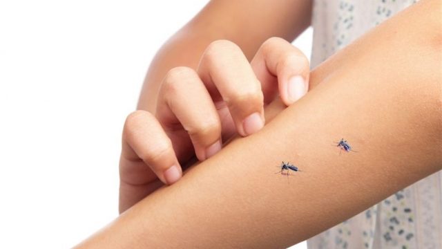 5 مواد منزلية للتخفيف من لسعات البعوض