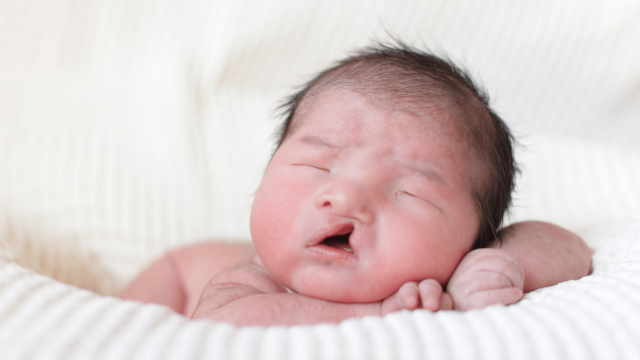 كل ما يجب أن تعرفيه عن مشكل الشفة الأرنبية عند الرضع