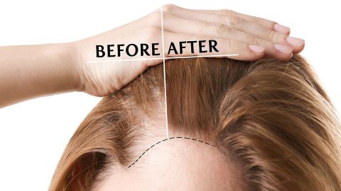 جربي بخاخات الأعشاب محلية الصنع لعلاج فراغات الشعر