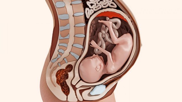 أسباب عدم نزول الجنين للحوض في الشهر التاسع