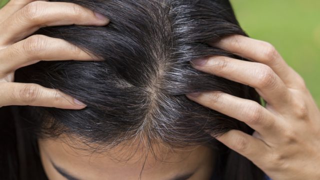 5 أطعمة لتأخير ظهور الشيب