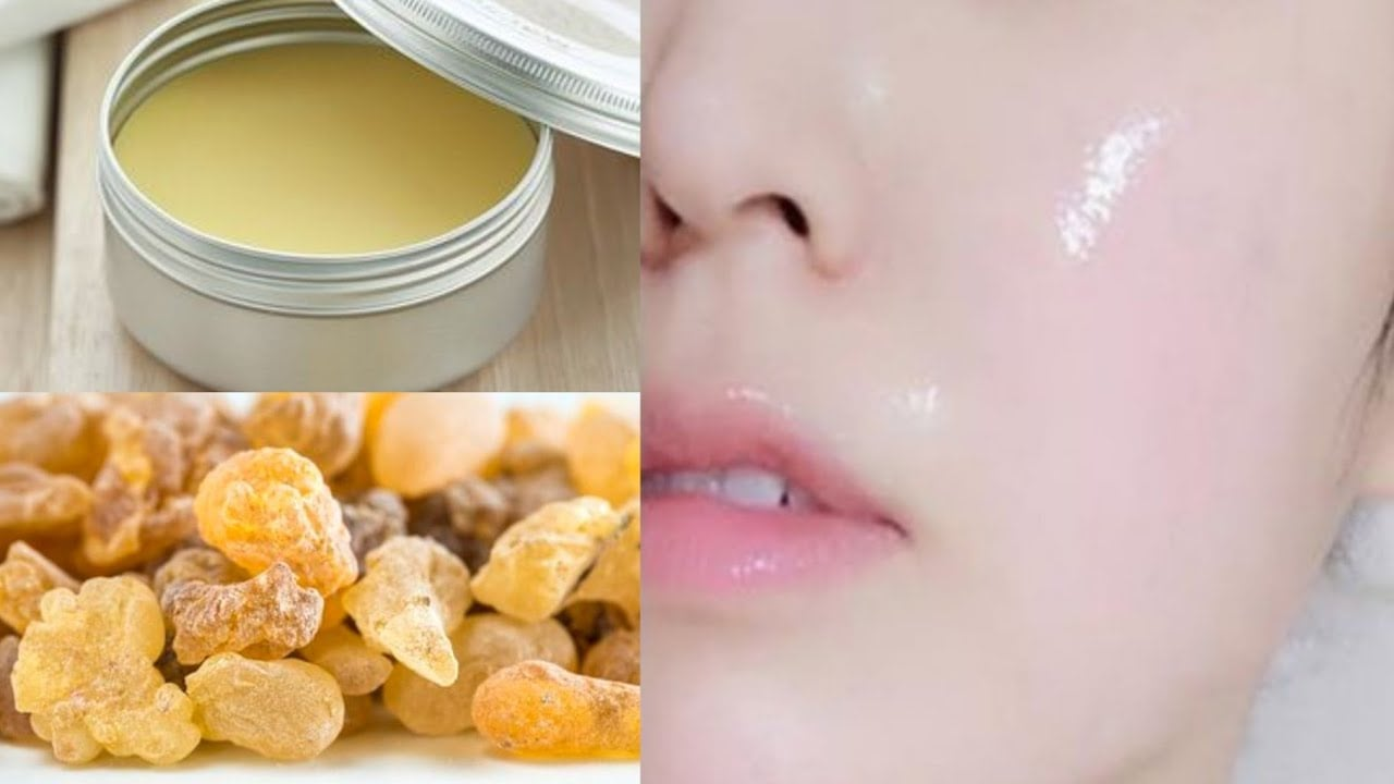 فوائد لبان الذكر للبشرة 