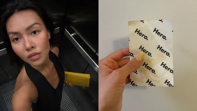 6 علاجات موضعية فعالة ضد الحبوب